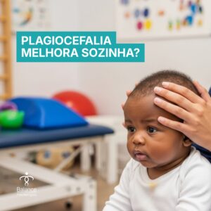 plagiocefalia-melhora-sozinha